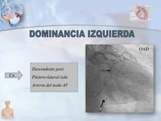 Cx
Descendente post.
Póstero-lateral izda
Arteria del nodo AV
OAD
DP
CX
 