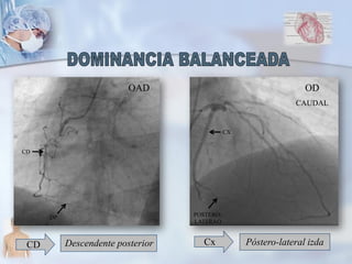 CD Descendente posterior Cx Póstero-lateral izda
OAD OD
CAUDAL
POSTERO-
LATERAO
DP
CX
CD
 