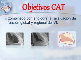 Objetivos CAT
◼ Combinado con angiografía: evaluación de
función global y regional del VI.
Circulation 2008;117;261-295
 