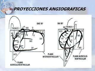 PROYECCIONES ANGIOGRAFICAS
 