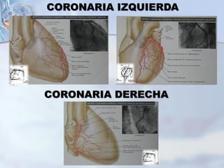 CORONARIA IZQUIERDA
CORONARIA DERECHA
 