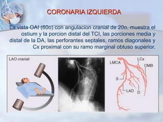 CORONARIA IZQUIERDA
La vista OAI (60o) con angulacion cranial de 20o, muestra el
ostium y la porcion distal del TCI, las porciones media y
distal de la DA, las perforantes septales, ramos diagonales y
Cx proximal con su ramo marginal obtuso superior.
 