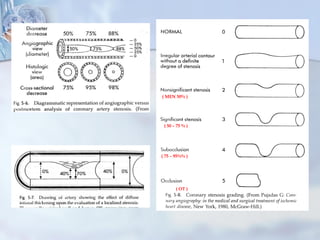 ( MEN 50% )
( 50 – 75 % )
( 75 – 95%% )
( OT )
 