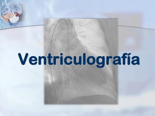 Ventriculografía
 