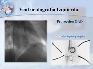 Ventriculografía Izquierda
Proyección OAD
Catéter Pig-Tail y Amplatz
 