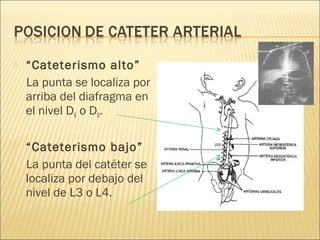    “Cateterismo alto”
    La punta se localiza por
    arriba del diafragma en
    el nivel D6 o D9.

   “Cateterismo bajo”
    La punta del catéter se
    localiza por debajo del
    nivel de L3 o L4.
 