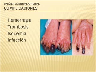    Hemorragia
   Trombosis
   Isquemia
   Infección
 