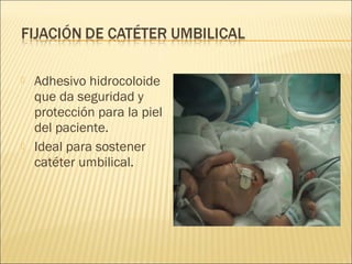    Adhesivo hidrocoloide
    que da seguridad y
    protección para la piel
    del paciente.
   Ideal para sostener
    catéter umbilical.
 