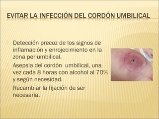    Detección precoz de los signos de
    inflamación y enrojecimiento en la
    zona periumbilical.
   Asepsia del cordón umbilical, una
    vez cada 8 horas con alcohol al 70%
    y según necesidad.
   Recambiar la fijación de ser
    necesaria.
 