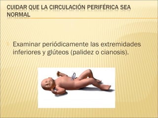    Examinar periódicamente las extremidades
    inferiores y glúteos (palidez o cianosis).
 