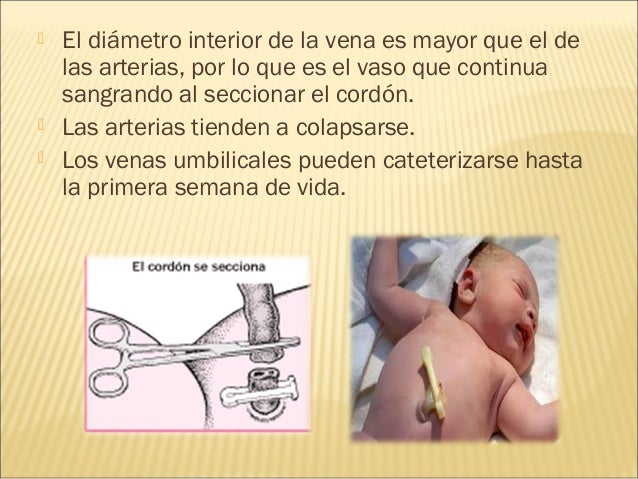 Varikobuster de varikoza las revocaciones