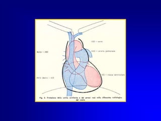  Evitare di far procedere il catetere una volta posizionato e fissato . (rischio infettivo)