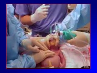 Dove/QuandoSala PartoReparto