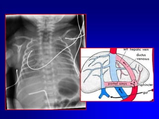 Non coprire il moncone ombelicale (sanguinamenti e/o dislocazioni )