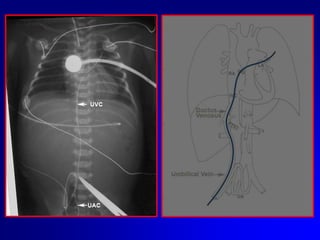   Ripulire con Soluzione Fisiologica 