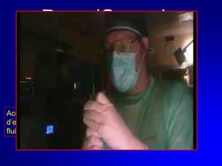 Dove/QuandoSala PartoRepartoAccesso vascolare d’emergenza per infusione fluidi e terapie