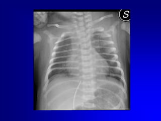CVO competenze infermieristiche Prima medicazione   cerotto con compressa   centraleMEDICAZIONE:GESTIONE: Parametri vitali