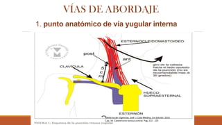 cateterismo-venoso-central-pdf