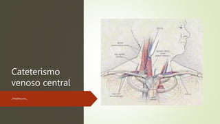 Cateterismo
venoso central
_MediNeumo_
 