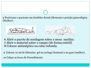 5 Posicionar o paciente em decúbito dorsal (Homem) e posição ginecológica
(Mulher).




 6 Abrir o pacote de sondagem sobre a mesa auxiliar.
 7 Abrir o material sobre o campo (de forma estéril)
 8 Colocar antisséptico na cuba redonda.

9 Colocar 10 ml de lidocaina gel na seringa (homem) e na gaze (mulher).
10 Calçar as luvas de Procedimento
 