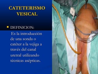 CATETERISMO
      VESICAL

   DEFINICION:
     Es la introducción
    de una sonda o
    catéter a la vejiga a
    través del canal
    uretral utilizando
    técnicas asépticas.
 
