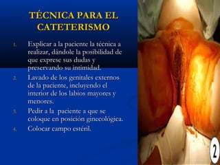 TÉCNICA PARA EL
      CATETERISMO
1.   Explicar a la paciente la técnica a
     realizar, dándole la posibilidad de
     que exprese sus dudas y
     preservando su intimidad.
2.   Lavado de los genitales externos
     de la paciente, incluyendo el
     interior de los labios mayores y
     menores.
3.   Pedir a la paciente a que se
     coloque en posición ginecológica.
4.   Colocar campo estéril.
 