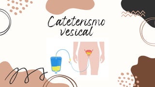 Cateterismo
vesical
 