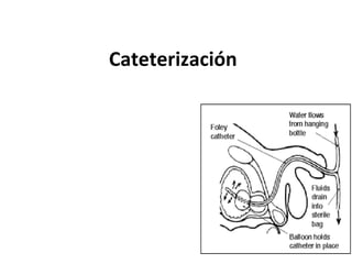 Cateterización 