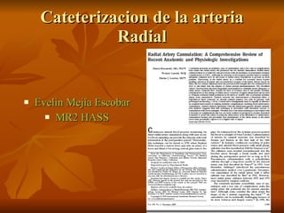 Cateterizacion de la arteria Radial ,[object Object],[object Object]