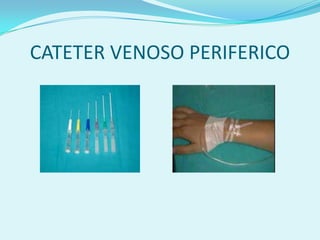 CATETER VENOSO PERIFERICO
 