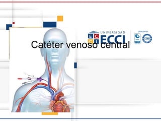 Catéter venoso central
 