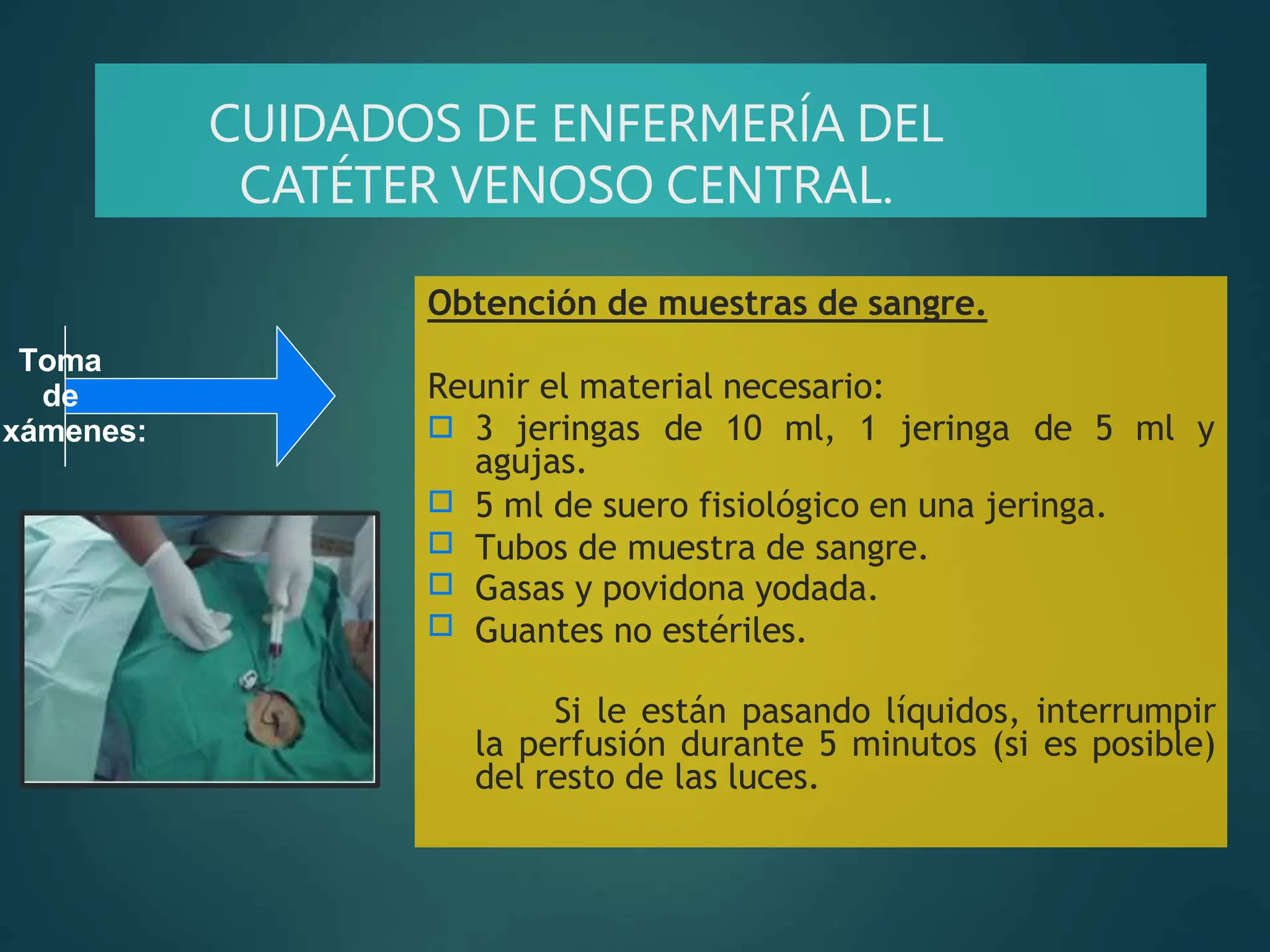Cateter Venoso Central CURACION MANEJO Y MANTENIMIENTO | PPTX