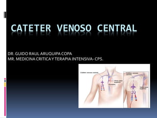 CATETER VENOSO CENTRAL
DR. GUIDO RAULARUQUIPA COPA
MR. MEDICINACRITICAYTERAPIA INTENSIVA-CPS.
 