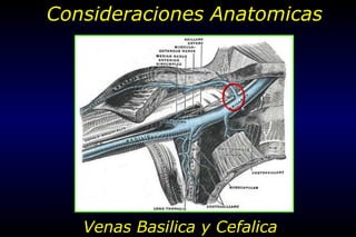 Venas Basilica y Cefalica
Consideraciones Anatomicas
 