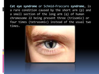 Cat eye syndrome or Schmid–Fraccaro syndrome, is
a rare condition caused by the short arm (p) and
a small section of the long arm (q) of human
chromosome 22 being present three (trisomic) or
four times (tetrasomic) instead of the usual two
times.
 