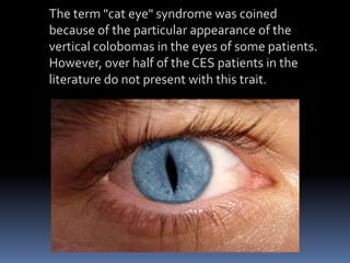 The term "cat eye" syndrome was coined
because of the particular appearance of the
vertical colobomas in the eyes of some patients.
However, over half of the CES patients in the
literature do not present with this trait.
 