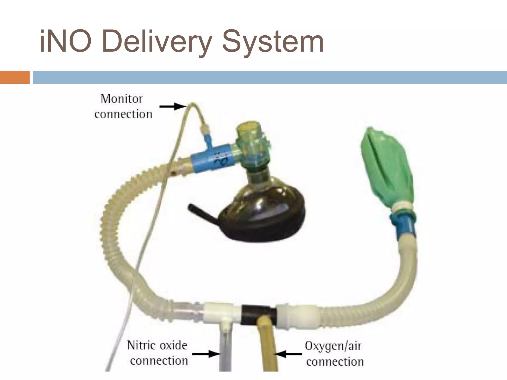 Ino Delivery System Catheterisation study and operability assessment | PPT