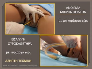 ΕΙΣΑΓΩΓΗ
ΟΥΡΟΚΑΘΕΤΗΡΑ
με κυρίαρχο χέρι
ΑΣΗΠΤΗ ΤΕΧΝΙΚΗ
ΑΝΟΙΓΜΑ
ΜΙΚΡΩΝ ΧΕΙΛΕΩΝ
με μη κυρίαρχο χέρι
4ο ΕΚ ΠΕΡΙΣΤΕΡΙΟΥ- Εργαστήριο Νοσηλευτικής
 