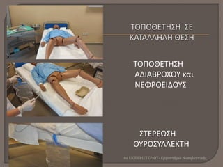 ΤΟΠΟΘΕΤΗΣΗ
ΑΔΙΑΒΡΟΧΟΥ και
ΝΕΦΡΟΕΙΔΟΥΣ
ΣΤΕΡΕΩΣΗ
ΟΥΡΟΣΥΛΛΕΚΤΗ
4ο ΕΚ ΠΕΡΙΣΤΕΡΙΟΥ- Εργαστήριο Νοσηλευτικής
 