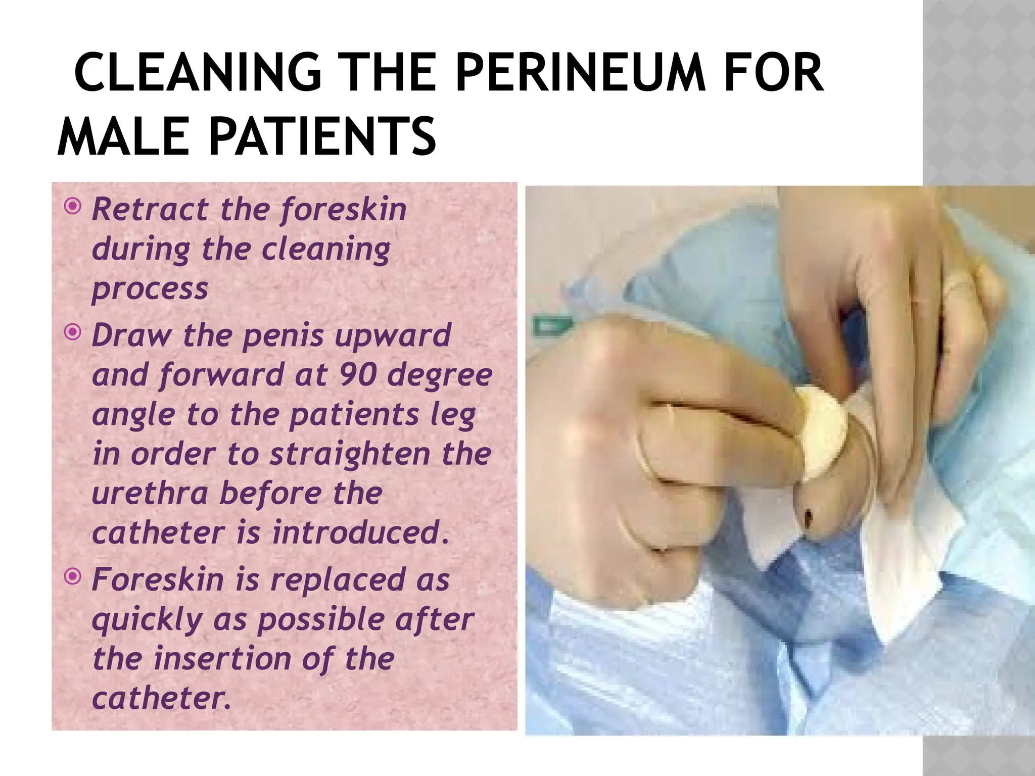 CLEANING THE PERINEUM FOR
MALE PATIENTS
 Retract the foreskin
during the cleaning
process
 Draw the penis upward
and forward at 90 degree
angle to the patients leg
in order to straighten the
urethra before the
catheter is introduced.
 Foreskin is replaced as
quickly as possible after
the insertion of the
catheter.
 