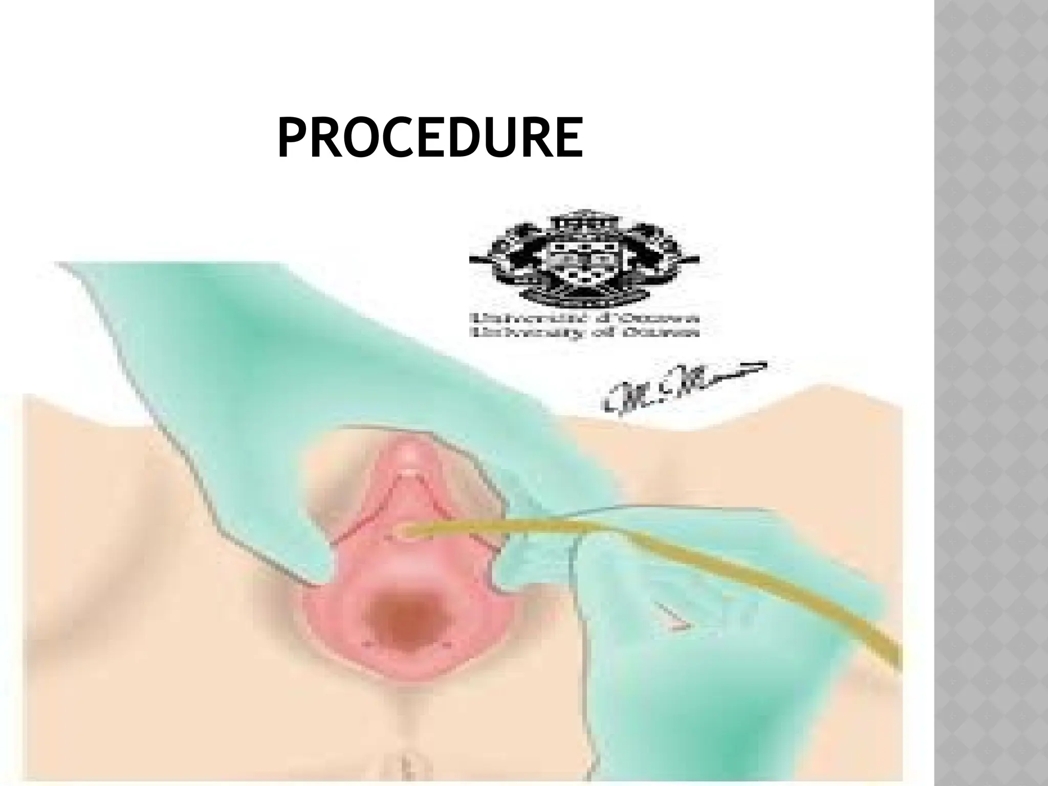 PROCEDURE
 