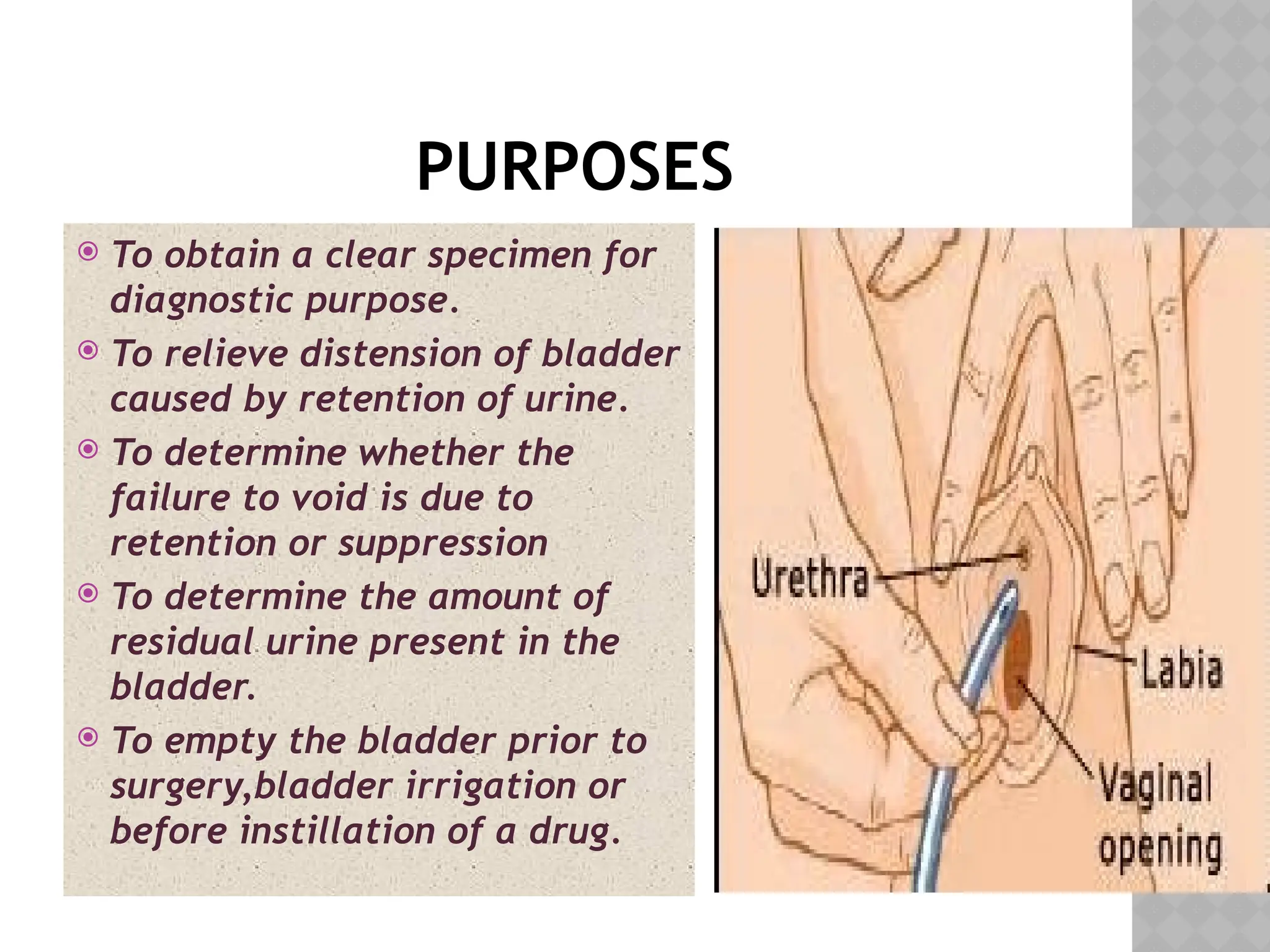 PURPOSES
 To obtain a clear specimen for
diagnostic purpose.
 To relieve distension of bladder
caused by retention of urine.
 To determine whether the
failure to void is due to
retention or suppression
 To determine the amount of
residual urine present in the
bladder.
 To empty the bladder prior to
surgery,bladder irrigation or
before instillation of a drug.
 