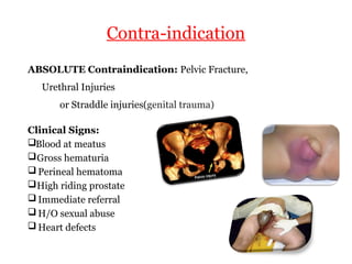High Riding Prostate Sign Urinary catheterization of both male and female | PPTX