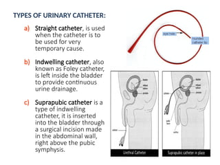 TYPES OF URINARY CATHETER:
a) Straight catheter, is used
when the catheter is to
be used for very
temporary cause.
b) Indwelling catheter, also
known as Foley catheter,
is left inside the bladder
to provide continuous
urine drainage.
c) Suprapubic catheter is a
type of indwelling
catheter, it is inserted
into the bladder through
a surgical incision made
in the abdominal wall,
right above the pubic
symphysis.
 