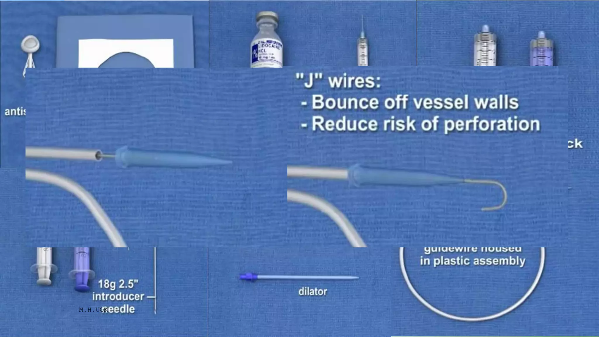 Catheters | PPTX