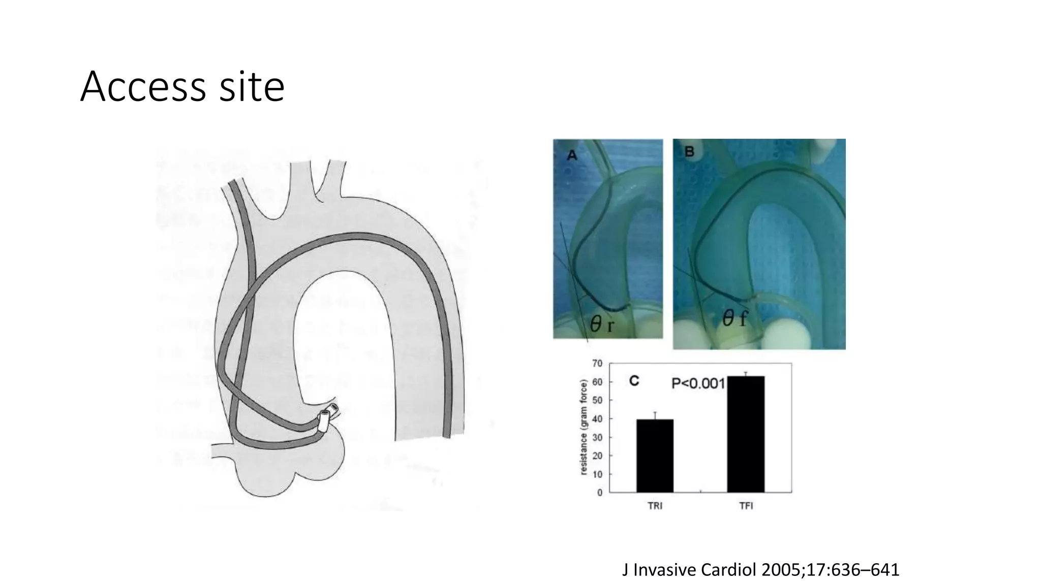 catheters.pptx