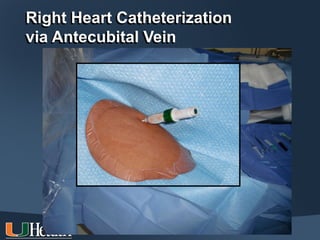 Right Heart Catheterization
via Antecubital Vein
 