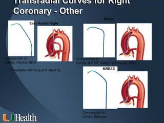 Transradial Curves for Right                                                ITS 2011

    Coronary - Other
                                                         RRAD
                Easy Radial Right




Comparable to:                           Comparable to:
Cordis: Hockey Stick                     Cordis: RB MP (Saito Technique), BRC

   * Available with long and short tip                  MRESS




                                            Comparable to:
                                            Cordis: Barbeau
 