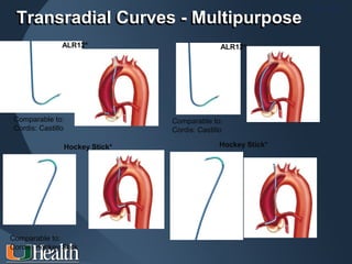 ITS 2011
 Transradial Curves - Multipurpose
                ALR12*                         ALR12*




 Comparable to:                 Comparable to:
 Cordis: Castillo               Cordis: Castillo

                Hockey Stick*                 Hockey Stick*




Comparable to:
Cordis: Hockey Stick
 