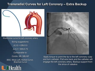 ITS 2011
    Transradial Curves for Left Coronary – Extra Backup
    Transradial Curves for Left Coronary – Extra Backup




Workhorse curve for left coronary artery
          Sizing suggestions:
           JL3.5 = EBU3.5
           JL4.0 = EBU3.75
            Comparable to:
          Cordis: XB, XBLAD                Apply torque to point the tip to the left coronary cusp
    BSC: Muta Left, Radial Curve,          and turn catheter. Pull wire back and the catheter will
          Brachial Curve                   engage the left coronary artery. Backup support from
                                                            the sinus of valsalva
 
